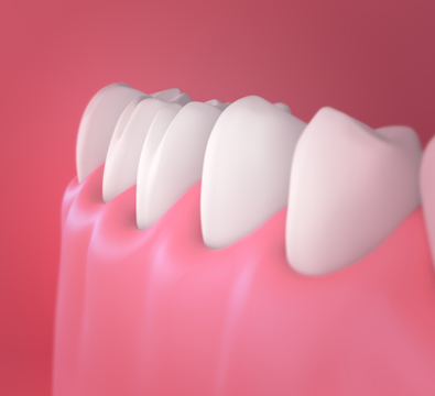 Prosthodontics - Cassiobury Dental Practice